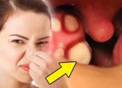 7 راه حل موثر برای برطرف بوی بد دهان 7 راه حل موثر برای برطرف بوی بد دهان