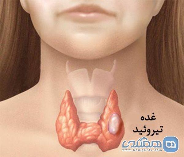 علائم شایع سرطان تیروئید